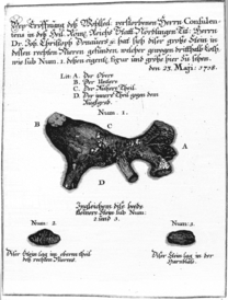 Nierenstein aus der Leichenpredigt auf Johann Christoph Donauer